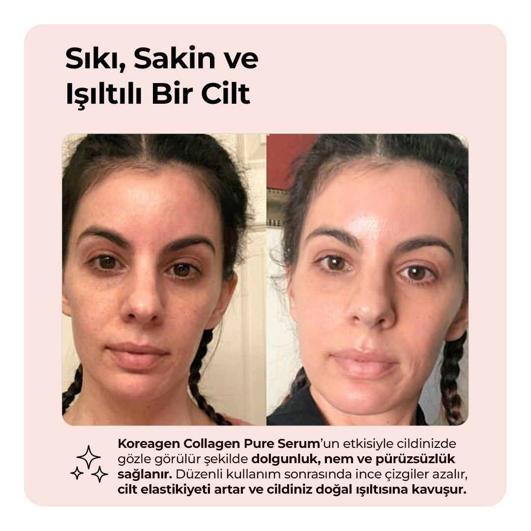 Koreagen Collagen Pure Serum