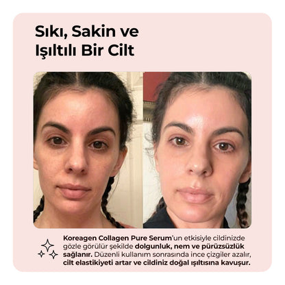 Koreagen Collagen Pure Serum