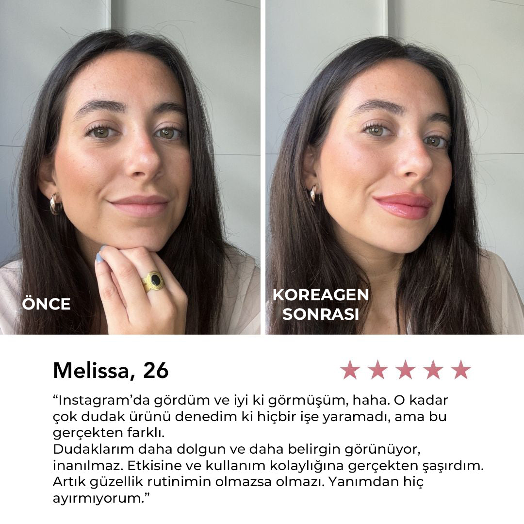 Koreagen Dudak Dolgunlaştırıcı