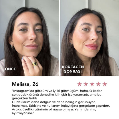 Koreagen Dudak Dolgunlaştırıcı